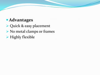  Advantages
 Quick & easy placement
 No metal clamps or frames
 Highly flexible
 