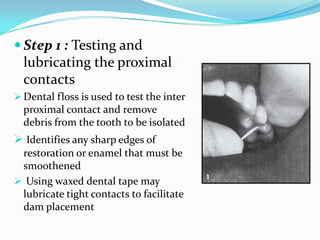 Step 1 : Testing and
lubricating the proximal
contacts
 Dental floss is used to test the inter
proximal contact and remove
debris from the tooth to be isolated
 Identifies any sharp edges of
restoration or enamel that must be
smoothened
 Using waxed dental tape may
lubricate tight contacts to facilitate
dam placement
 