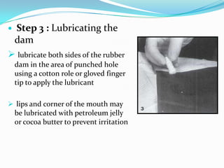  Step 3 : Lubricating the
dam
 lubricate both sides of the rubber
dam in the area of punched hole
using a cotton role or gloved finger
tip to apply the lubricant
 lips and corner of the mouth may
be lubricated with petroleum jelly
or cocoa butter to prevent irritation
 