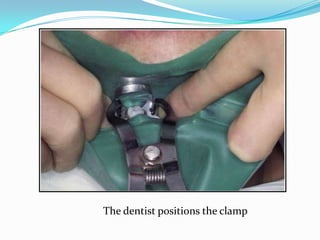 The dentist positions the clamp
 