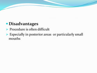  Disadvantages
 Procedure is often difficult
 Especially in posterior areas or particularly small
mouths
 