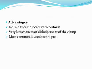  Advantages :
 Not a difficult procedure to perform
 Very less chances of dislodgement of the clamp
 Most commomly used technique
 
