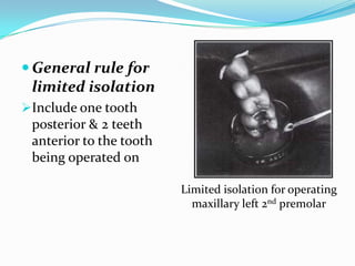  General rule for
limited isolation
Include one tooth
posterior & 2 teeth
anterior to the tooth
being operated on
Limited isolation for operating
maxillary left 2nd premolar
 