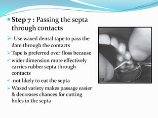  Step 7 : Passing the septa
through contacts
 Use waxed dental tape to pass the
dam through the contacts
 Tape is preferred over floss because
 wider dimension more effectively
carries rubber septa through
contacts
 not likely to cut the septa
 Waxed variety makes passage easier
& decreases chances for cutting
holes in the septa
 