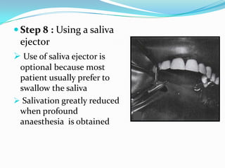  Step 8 : Using a saliva
ejector
 Use of saliva ejector is
optional because most
patient usually prefer to
swallow the saliva
 Salivation greatly reduced
when profound
anaesthesia is obtained
 