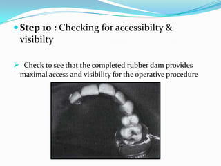  Step 10 : Checking for accessibilty &
visibilty
 Check to see that the completed rubber dam provides
maximal access and visibility for the operative procedure
 