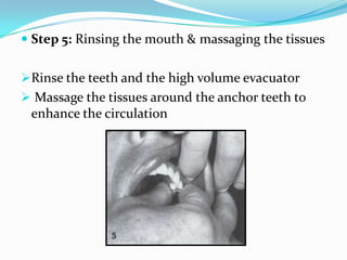  Step 5: Rinsing the mouth & massaging the tissues
Rinse the teeth and the high volume evacuator
 Massage the tissues around the anchor teeth to
enhance the circulation
 