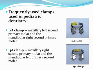  2A clamp -- first primary molars
 14 clamp -- fully erupted permanent
molars
 14A clamp -- partially erupted
permanent...