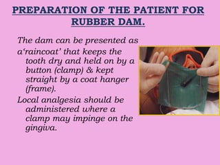 PREPARATION OF THE PATIENT FOR
RUBBER DAM.
The dam can be presented as
a‘raincoat’ that keeps the
tooth dry and held on by a
button (clamp) & kept
straight by a coat hanger
(frame).
Local analgesia should be
administered where a
clamp may impinge on the
gingiva.
 
