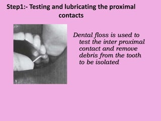 Step1:- Testing and lubricating the proximal
contacts
Dental floss is used to
test the inter proximal
contact and remove
debris from the tooth
to be isolated
 