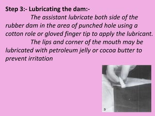 Step 3:- Lubricating the dam:-
The assistant lubricate both side of the
rubber dam in the area of punched hole using a
cotton role or gloved finger tip to apply the lubricant.
The lips and corner of the mouth may be
lubricated with petroleum jelly or cocoa butter to
prevent irritation
 