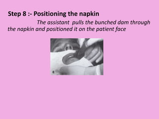 Step 8 :- Positioning the napkin
The assistant pulls the bunched dam through
the napkin and positioned it on the patient face
 