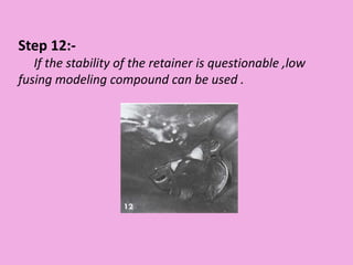 Step 12:-
If the stability of the retainer is questionable ,low
fusing modeling compound can be used .
 
