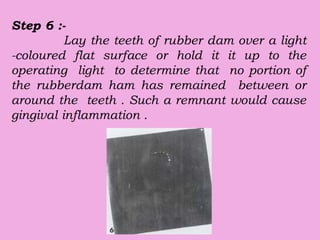 Step 6 :-
Lay the teeth of rubber dam over a light
-coloured flat surface or hold it it up to the
operating light to determine that no portion of
the rubberdam ham has remained between or
around the teeth . Such a remnant would cause
gingival inflammation .
 
