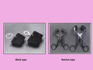 Block type Ratchet type
 