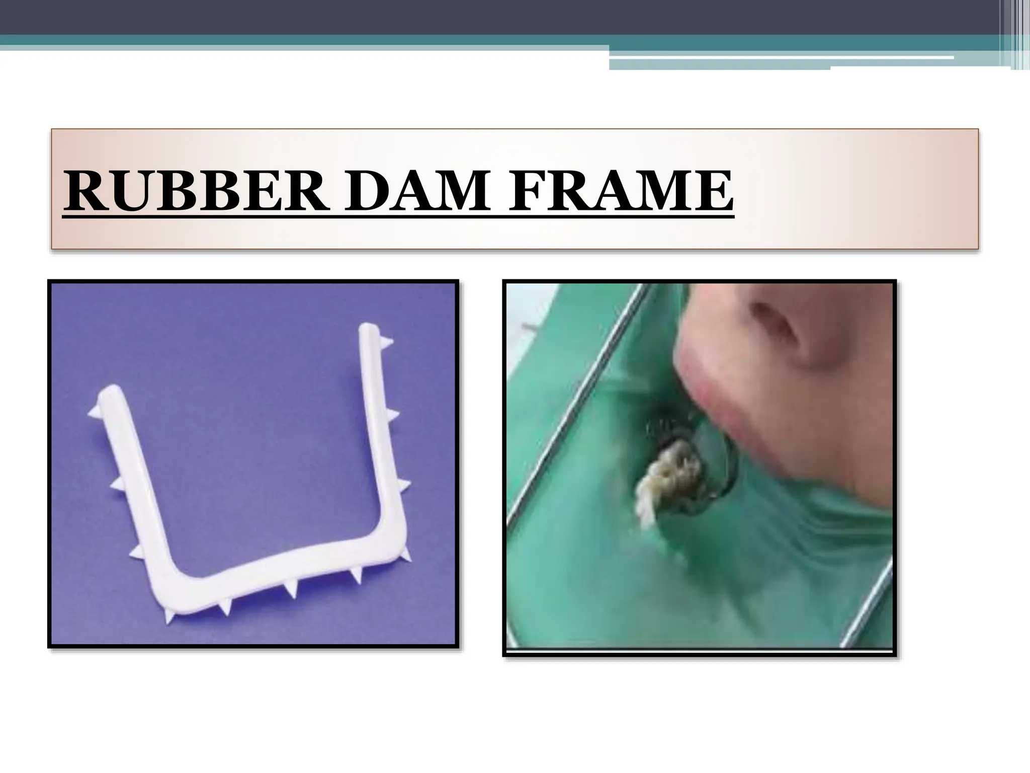 isolation types, advantages and disadvantages PPT