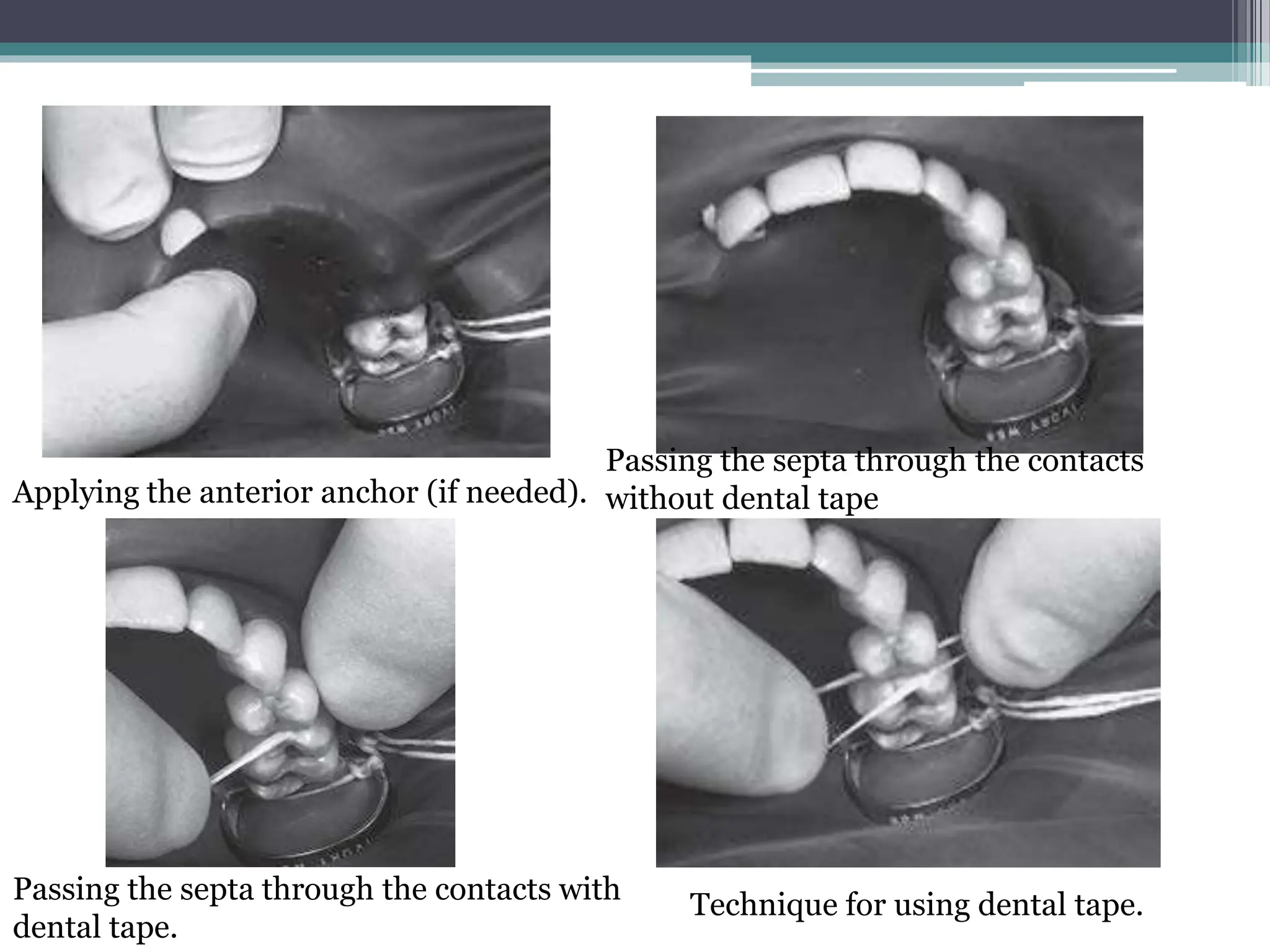 isolation types, advantages and disadvantages PPT