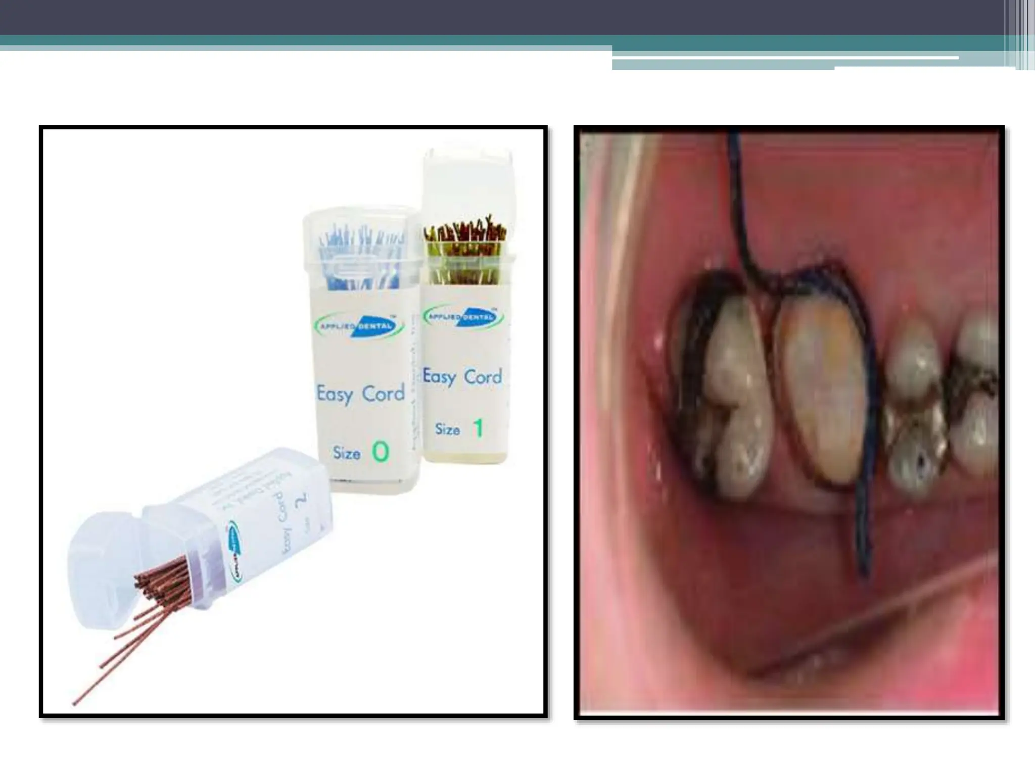 isolation types, advantages and disadvantages PPT