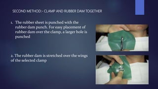 SECOND METHOD:- CLAMP AND RUBBER DAM TOGETHER
1. The rubber sheet is punched with the
rubber dam punch. For easy placement of
rubber dam over the clamp, a larger hole is
punched
2. The rubber dam is stretched over the wings
of the selected clamp
 