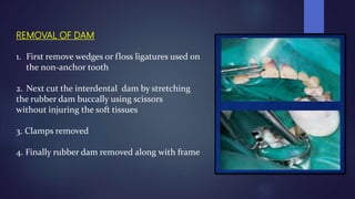 REMOVAL OF DAM
1. First remove wedges or floss ligatures used on
the non-anchor tooth
2. Next cut the interdental dam by stretching
the rubber dam buccally using scissors
without injuring the soft tissues
3. Clamps removed
4. Finally rubber dam removed along with frame
 