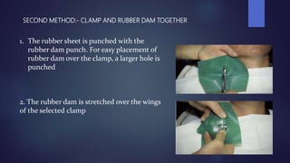 SECOND METHOD:- CLAMP AND RUBBER DAM TOGETHER
1. The rubber sheet is punched with the
rubber dam punch. For easy placement...