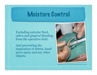 Moisture Control
Excluding sulcular fluid,
saliva and gingival bleeding
from the operative field.
And preventing the
inspi...