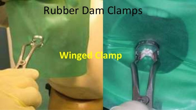 Placement of a winged clamp