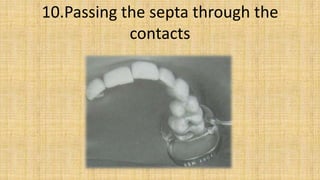 10.Passing the septa through the
            contacts
 