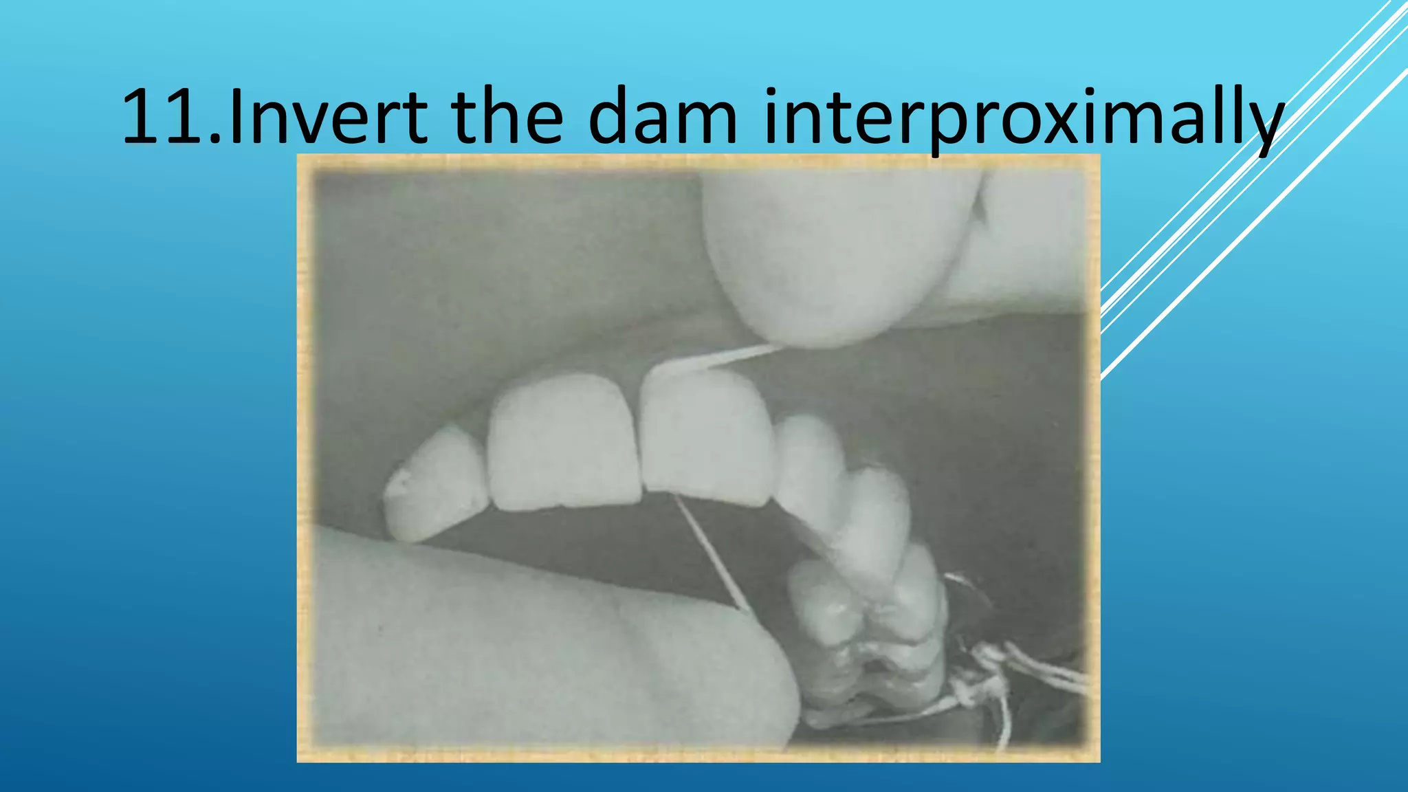 Isolation of the operative field | PPTX