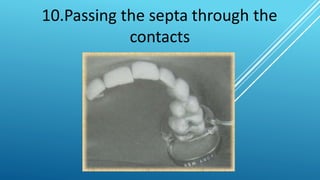Isolation of the operative field | PPTX