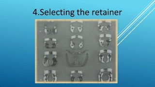 4.Selecting the retainer
 