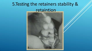 5.Testing the retainers stability &
retaintion
 