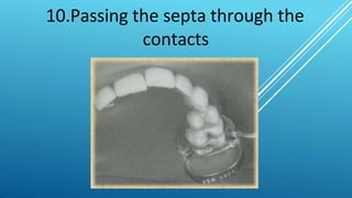 10.Passing the septa through the
contacts
 