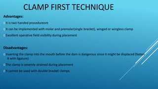 CLAMP FIRST TECHNIQUE
Advantages:
⯈ It is two handed procedureore
⯈ It can be implemented with molar and premolar(single bracket), winged or wingless clamp
⯈ Excellent operative field visibility during placement
Disadvantages:
⯈ Inserting the clamp into the mouth before the dam is dangerous since it might be displaced (fasten
it with ligature)
⯈ The clamp is severely strained during placement
⯈ It cannot be used with double bracket clamps
 