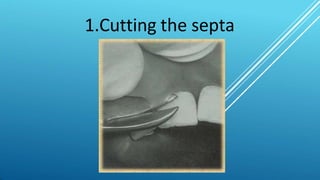 1.Cutting the septa
 