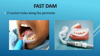FAST DAM
⯈17 suction holes along the perimeter
 