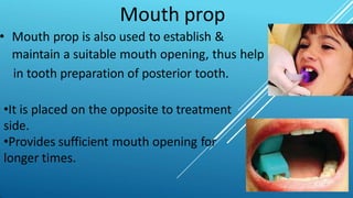 Mouth prop
• Mouth prop is also used to establish &
maintain a suitable mouth opening, thus help
in tooth preparation of posterior tooth.
•It is placed on the opposite to treatment
side.
•Provides sufficient mouth opening for
longer times.
 