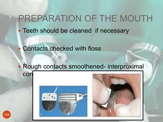 PREPARATION OF THE MOUTH
104
 Teeth should be cleaned if necessary
 Contacts checked with floss
 Rough contacts smoothe...