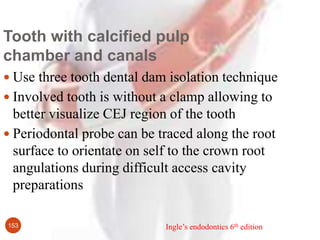 153
Tooth with calcified pulp
chamber and canals
 Use three tooth dental dam isolation technique
 Involved tooth is with...