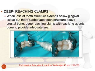 Endodontics: Principles & practice- Torabinajed 4th edn; 233-236
157
 DEEP- REACHING CLAMPS:
 When loss of tooth structu...