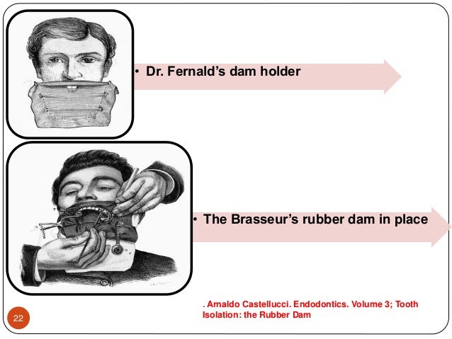 Arnaldo Castellucci Endodontics