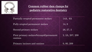 Common rubber dam clamps for
pediatric restorative dentistry
Partially erupted permanent molars
Fully erupted permanent mo...