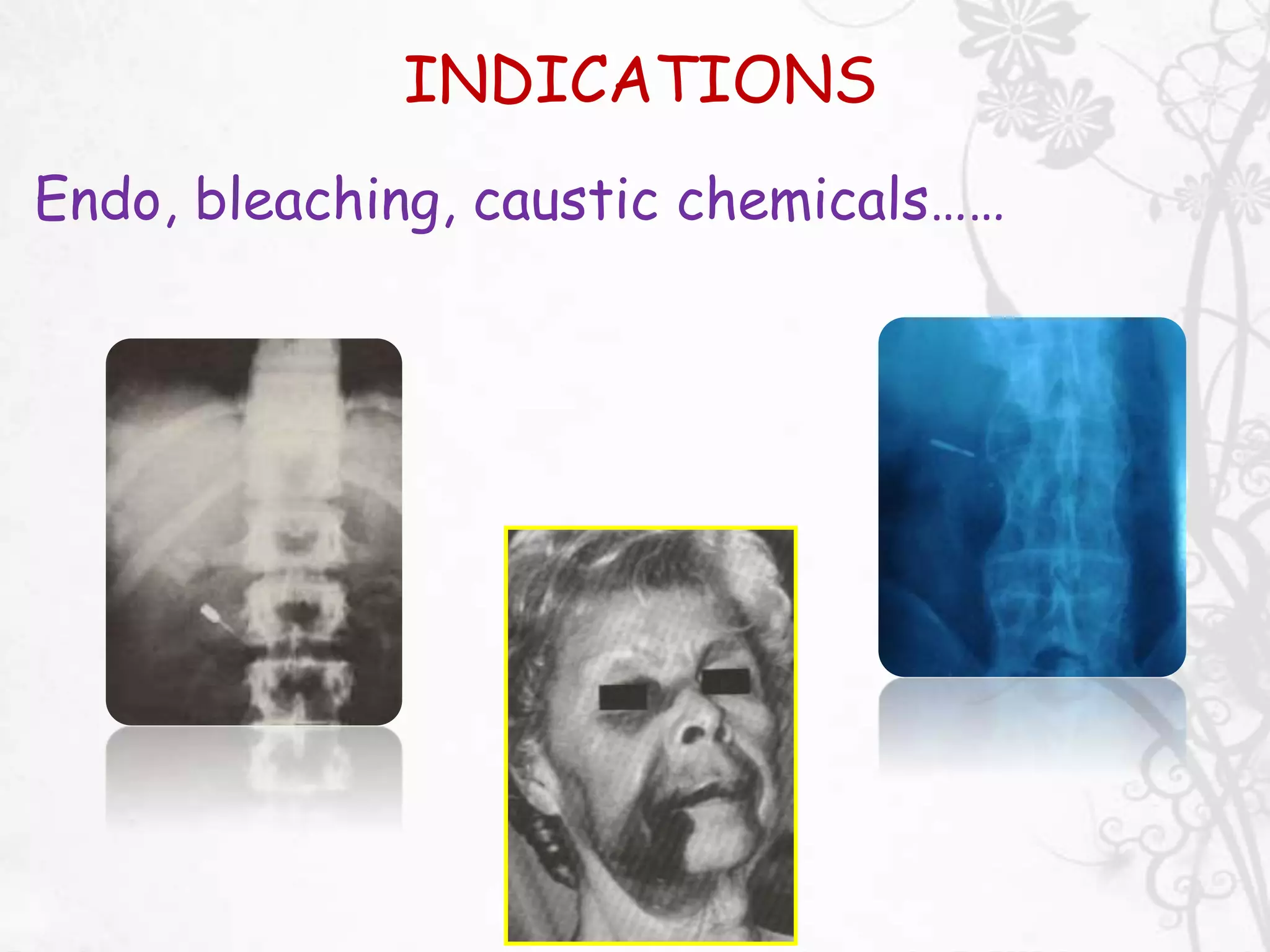 Isolation in Dentistry | PPTX