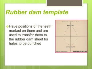 Rubber dam template
Have positions of the teeth
marked on them and are
used to transfer them to
the rubber dam sheet for
holes to be punched
 