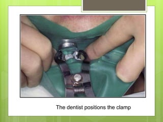 The dentist positions the clamp
 