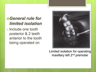 General rule for
limited isolation
 Include one tooth
posterior & 2 teeth
anterior to the tooth
being operated on
Limited isolation for operating
maxillary left 2nd premolar
 