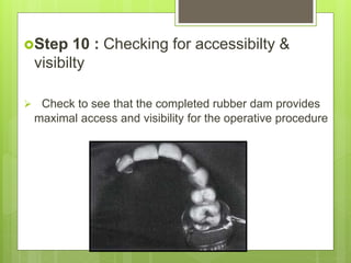 Step 10 : Checking for accessibilty &
visibilty
 Check to see that the completed rubber dam provides
maximal access and visibility for the operative procedure
 