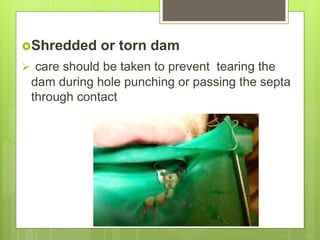 Shredded or torn dam
 care should be taken to prevent tearing the
dam during hole punching or passing the septa
through contact
 
