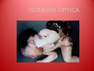 ISOMERIA ÓPTICA
 