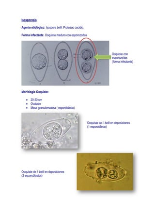 Isosporosis

Agente etiológico: Isospora belli. Protozoo cocidio.

Forma infectante: Ooquiste maduro con esporozoítos




                                                                           Ooquiste con
                                                                           esporozoítos
                                                                           (forma infectante)




Morfología Ooquiste:

       20-30 um
       Ovalado
       Masa granulomatosa ( esporoblasto)



                                                       Ooquiste de I. belli en deposiciones
                                                       (1 esporoblasto)




Ooquiste de I. belli en deposiciones
(2 esporoblastos)
 